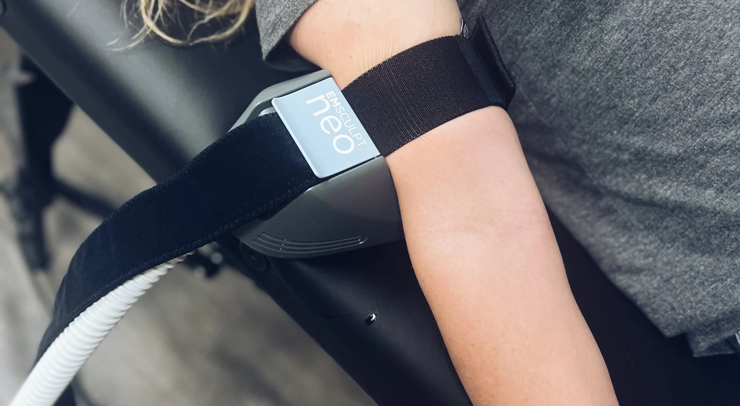 a patient getting treated by emsculpt neo on their triceps to burn fat and build muscle