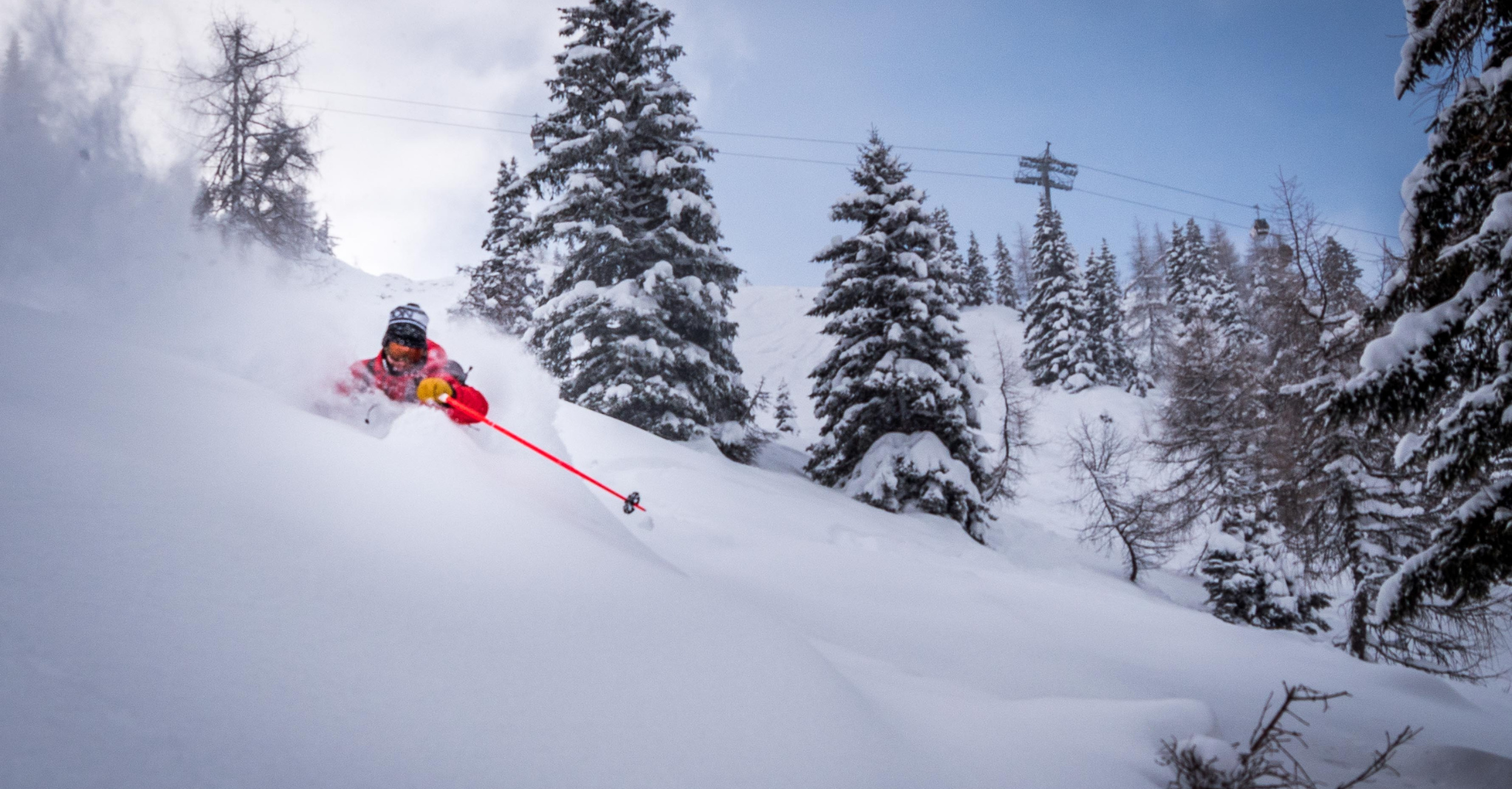 From Slopes to Strength: Winter Sports Injuries