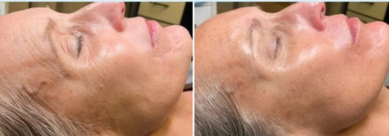 SWiCH single treatment comparison