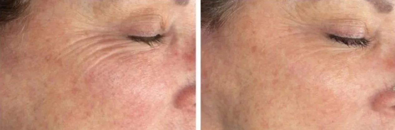 Procell comparison, before on the left and after on the right
