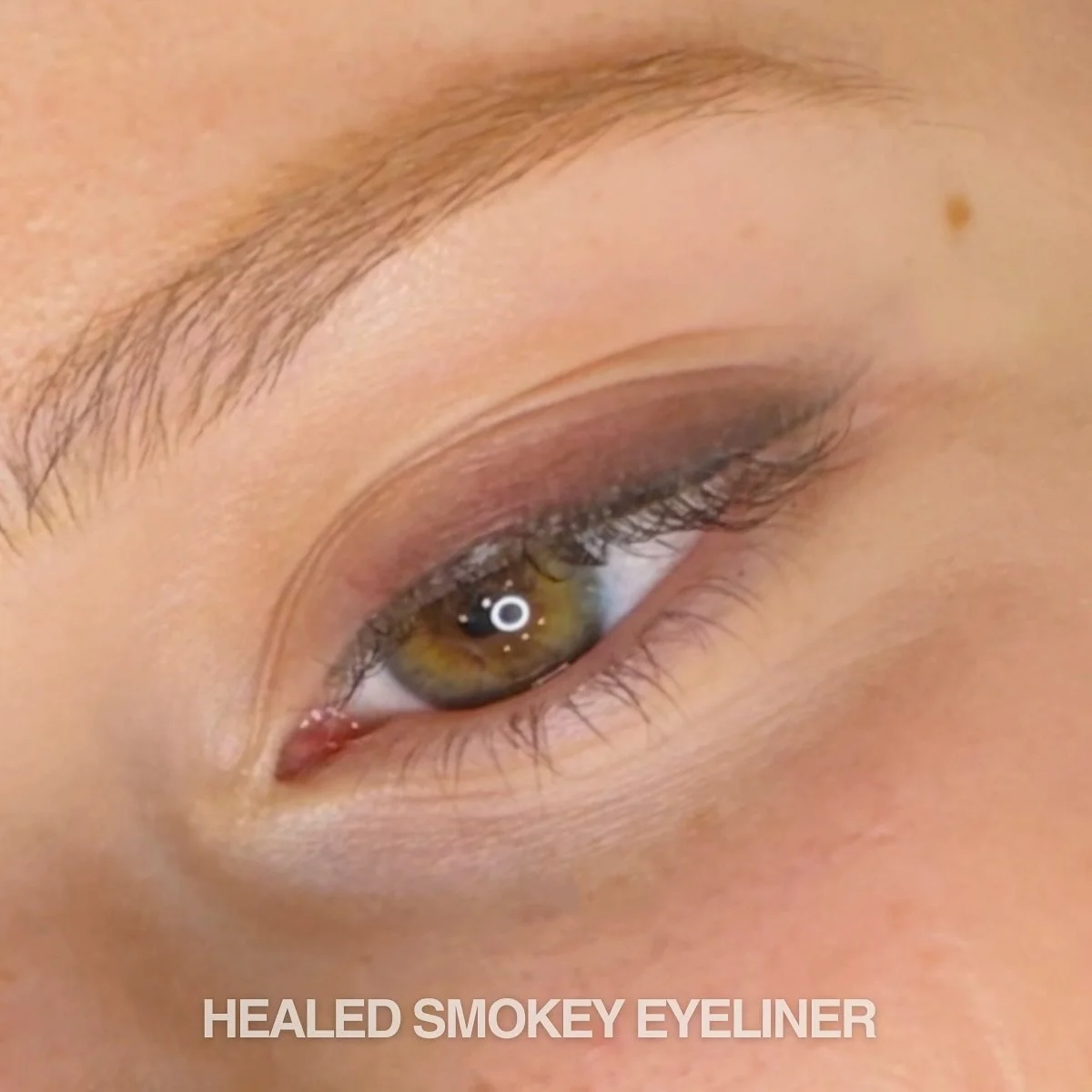 HEALED 😍
The perfect shape and amount of shadow for this sweet angel — keeping her results soft enough for her features. Just enough for everyday wear, but not over the top ✨