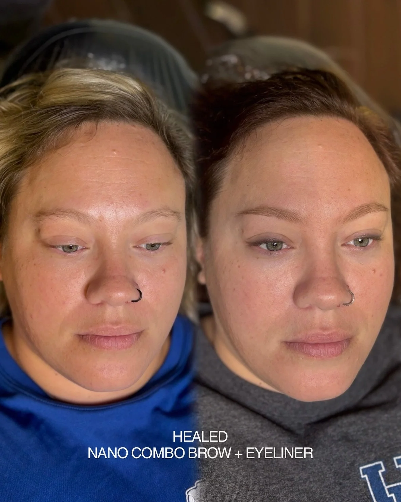 Subtle enhancements for a BIG transformation. Proof that a little pigment can go a long way 🪄 
Healed first session nano combo brow + soft smokey liner using only @hanafycolourspigments 
We did a minimal touch up on both and now she can wake up li