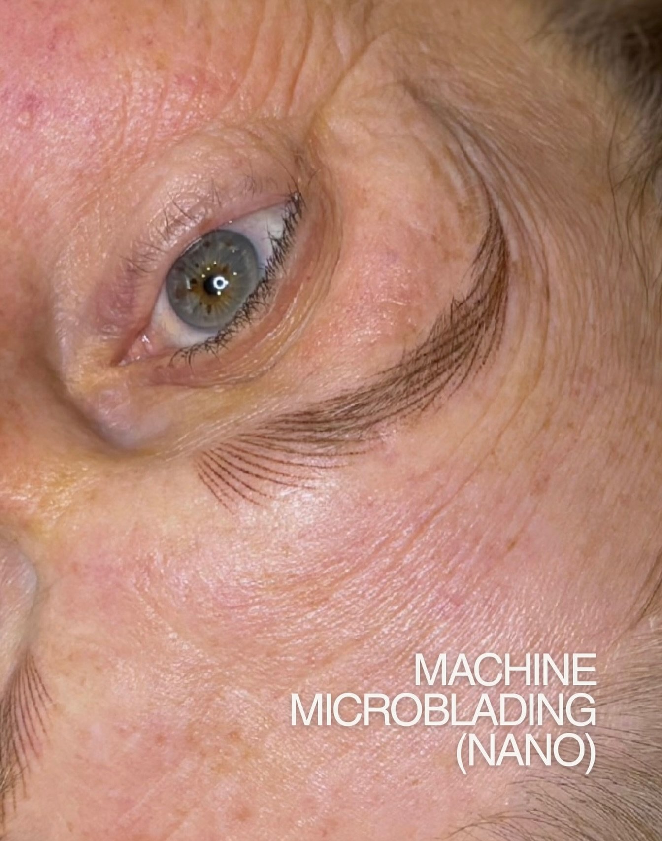 Suitable for her skin type and brow shape 👌🏻

The pigment I chose for her is meant to fade more than traditional PMU pigments, so these will likely need additional hair strokes at the touch up. For now, we&rsquo;ll space them apart slightly to allo