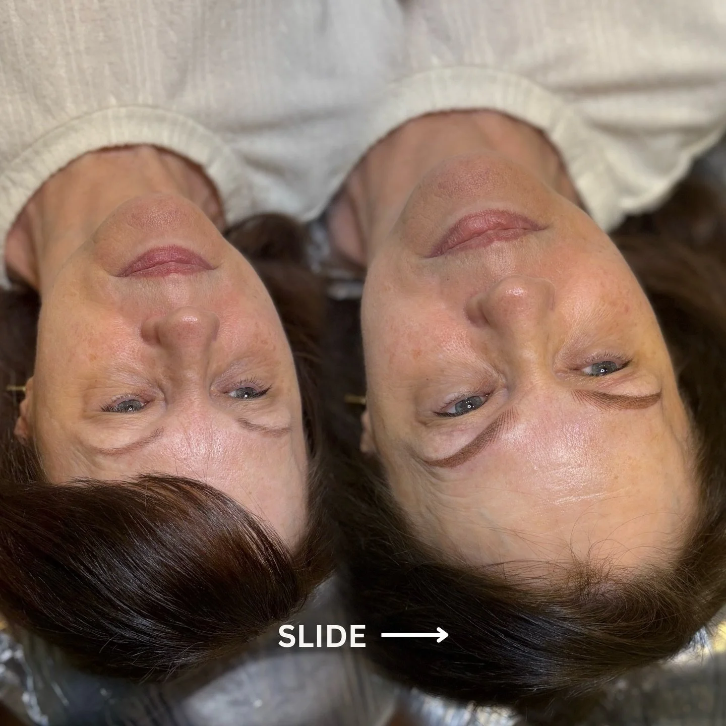 Combo Nano brows to cover/correct previous microblading ✨

Most of my clients tend to have skin that is thinner and more fragile, and existing microblading residue or past trauma can create pigment traps or scar tissue. This makes this skin type even