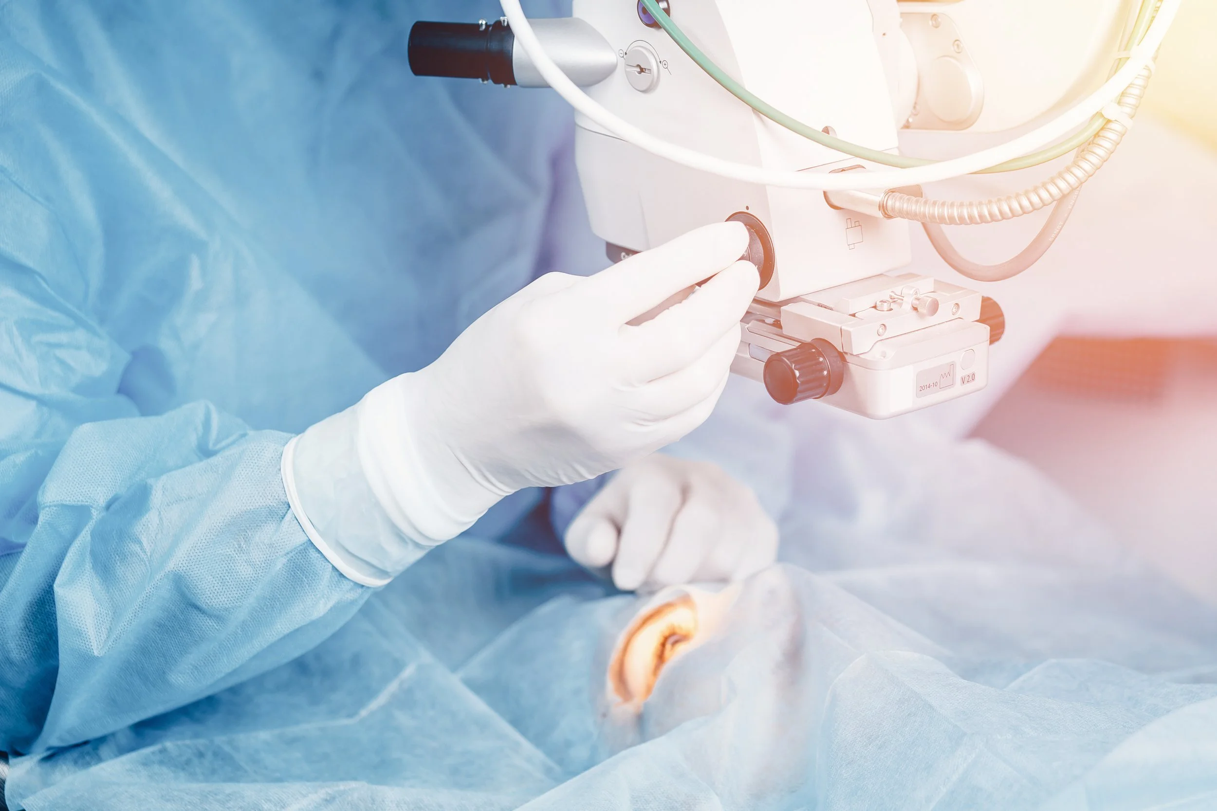 Cataract Surgery