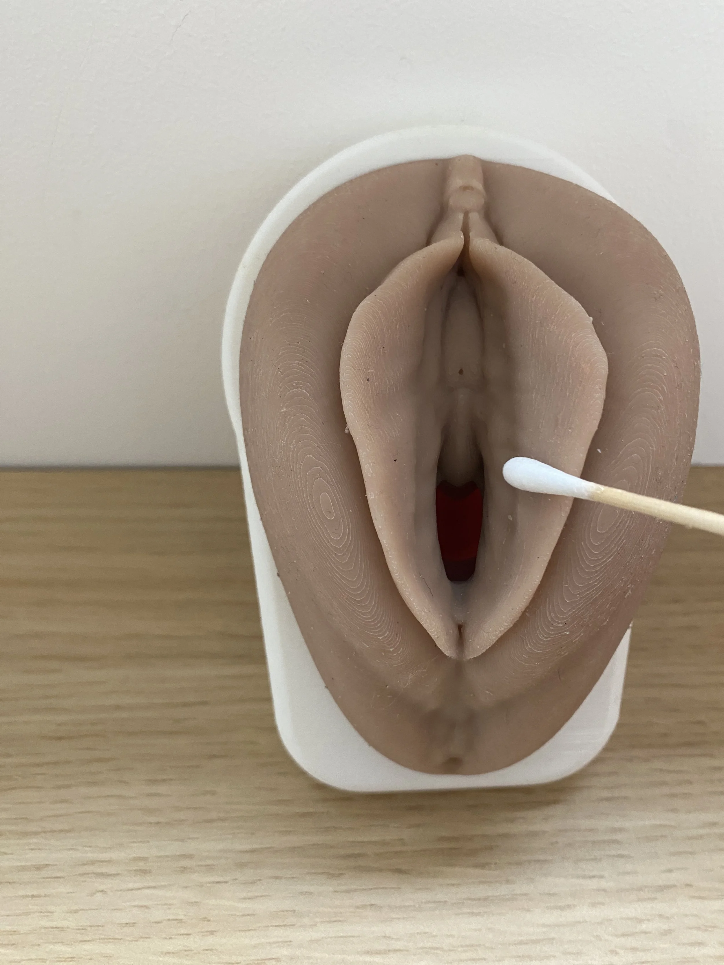 5 things to learn about vulvodynia