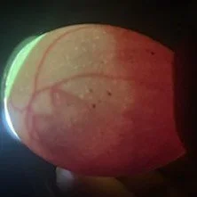 Day 10 0f 21 egg candling