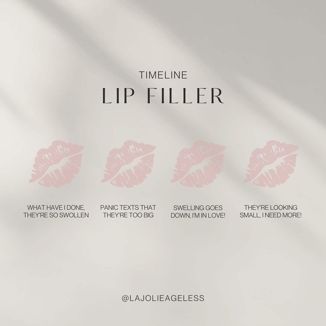 Everytime 😜

#LipFillerJourney #LipAugmentation #FillerTransformation #PlumpLips #LipEnhancement #LipFillerResults #PoutPerfection #LipFillerProcess #LusciousLips #LipFillerExperience #NaturalLips #LipTransformation #PerfectPout #BeautyEnhancement #