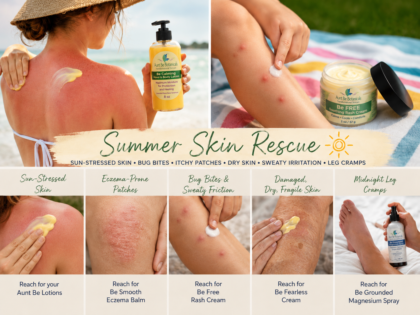 Summer Skin Rescue: What to Use for Sun-Stressed Skin, Bug Bites &amp; Itchy Patches