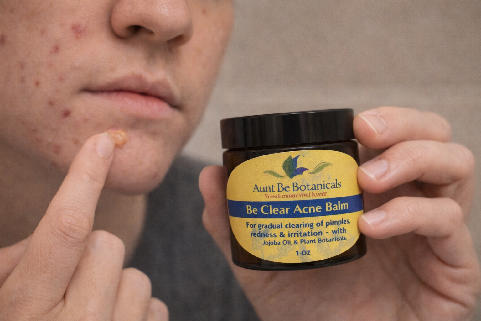 Be Clear Acne Fighting Face & Body Balm