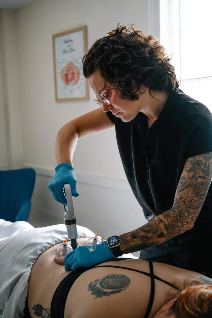 Cupping therapy for lower back and tailbone pain in Avon, CT