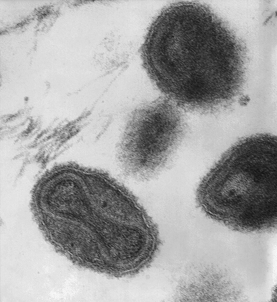 The smallpox virus under an electron microscope