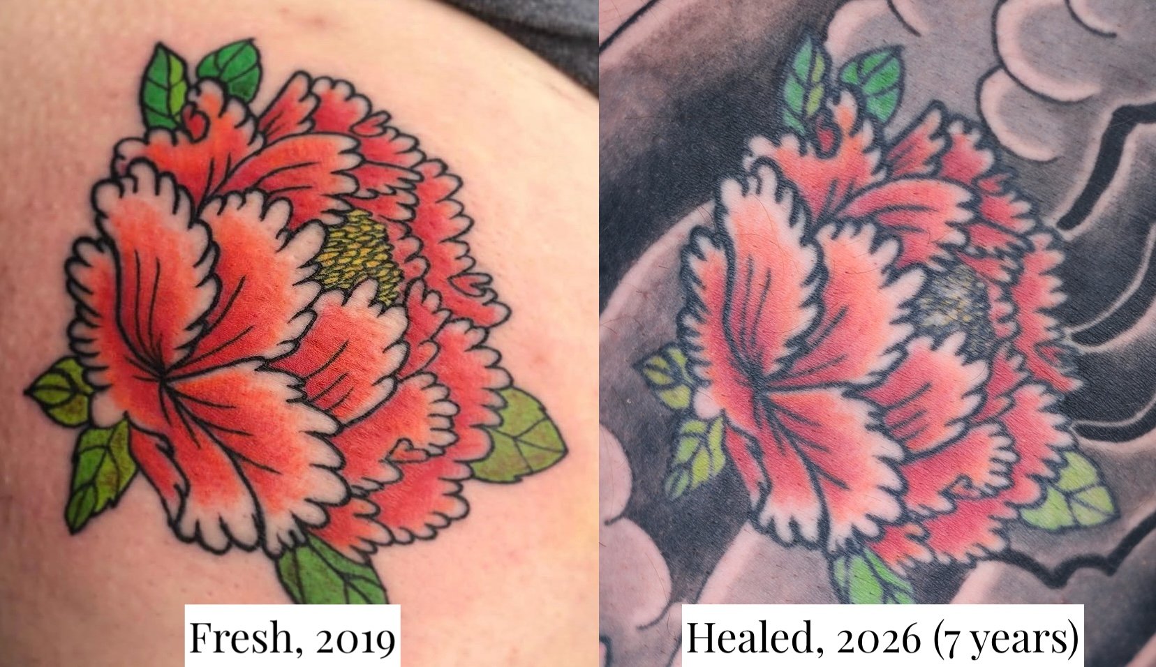 Peony, 7 years healed