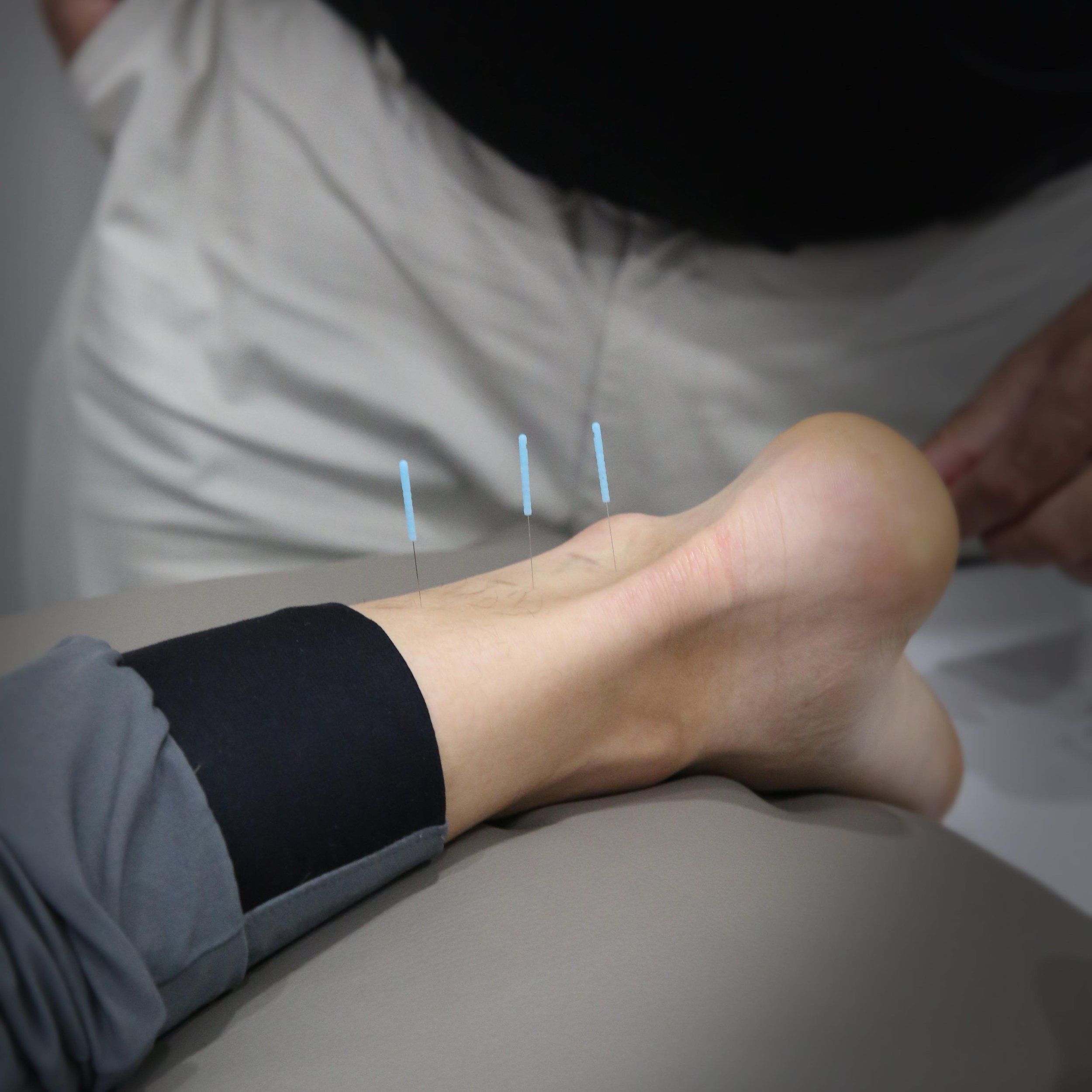 👣 ​Did you know ​​that​ ​our f​e​et and ankle​s ​have many energy pathways​? Acupuncture ​works by stimulating these points, unlocking the body&rsquo;s innate ability to heal.​ Here are just a couple of examples of acupuncture points on the feet and