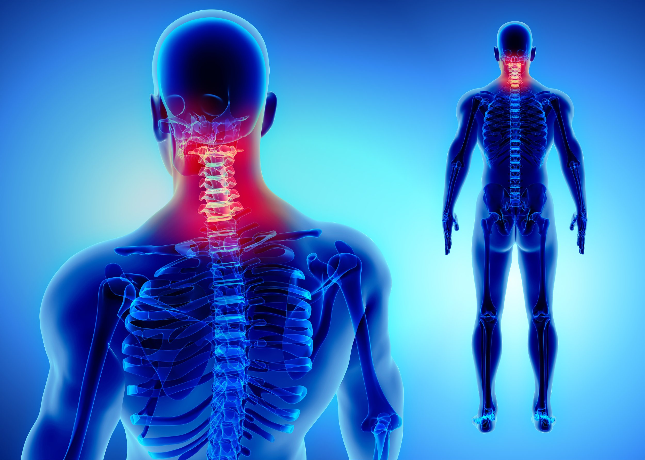 Upper Back Pain Treatment  Best Physical Therapists in Brooklyn