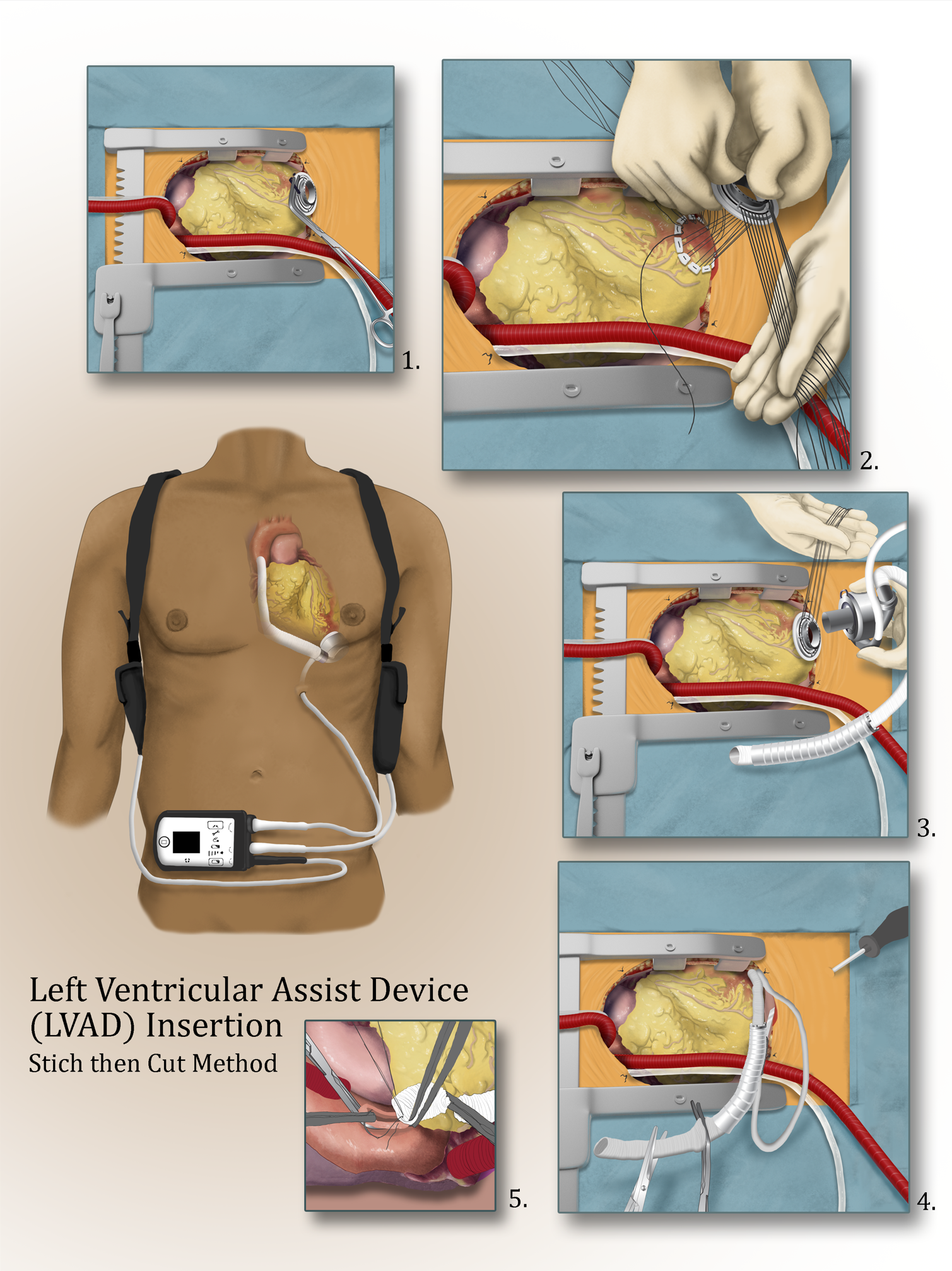 Screenshot 2023-06-20 150240.png