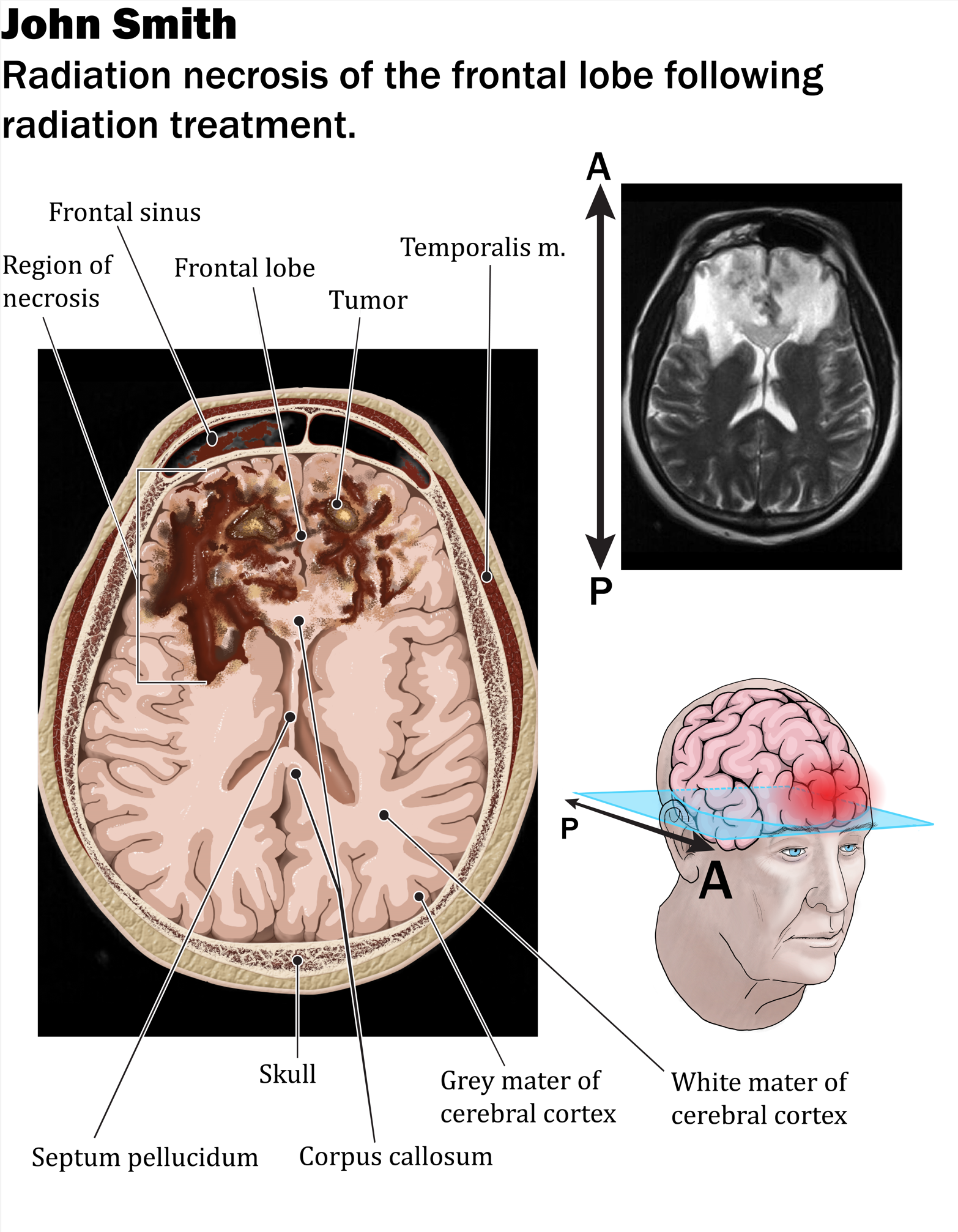 Necrotic Radiation.png