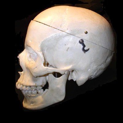 SIDE VIEW- SKULL