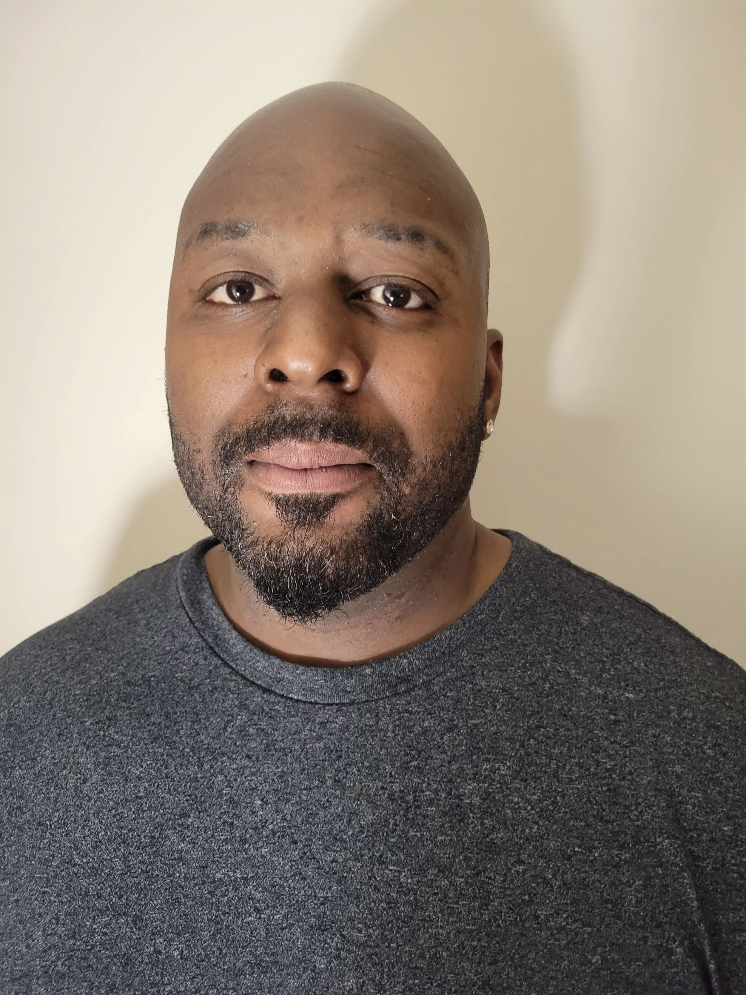 Healed Scar Application Before .jpg