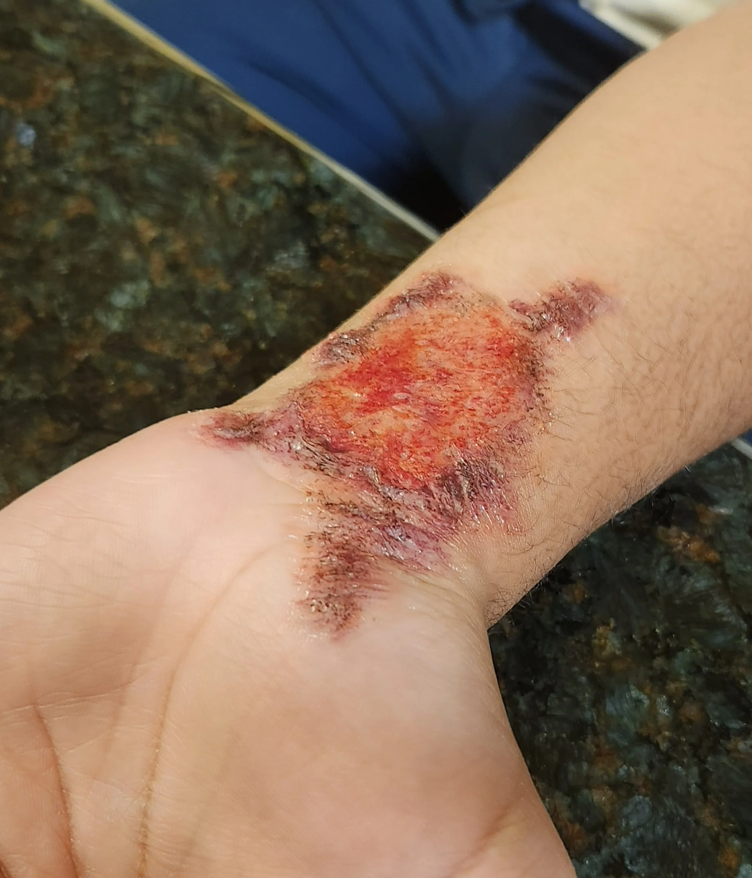 Burn Makeup After .jpg