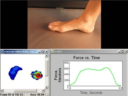 Matscan - Commack and East Setauket Podiatrist