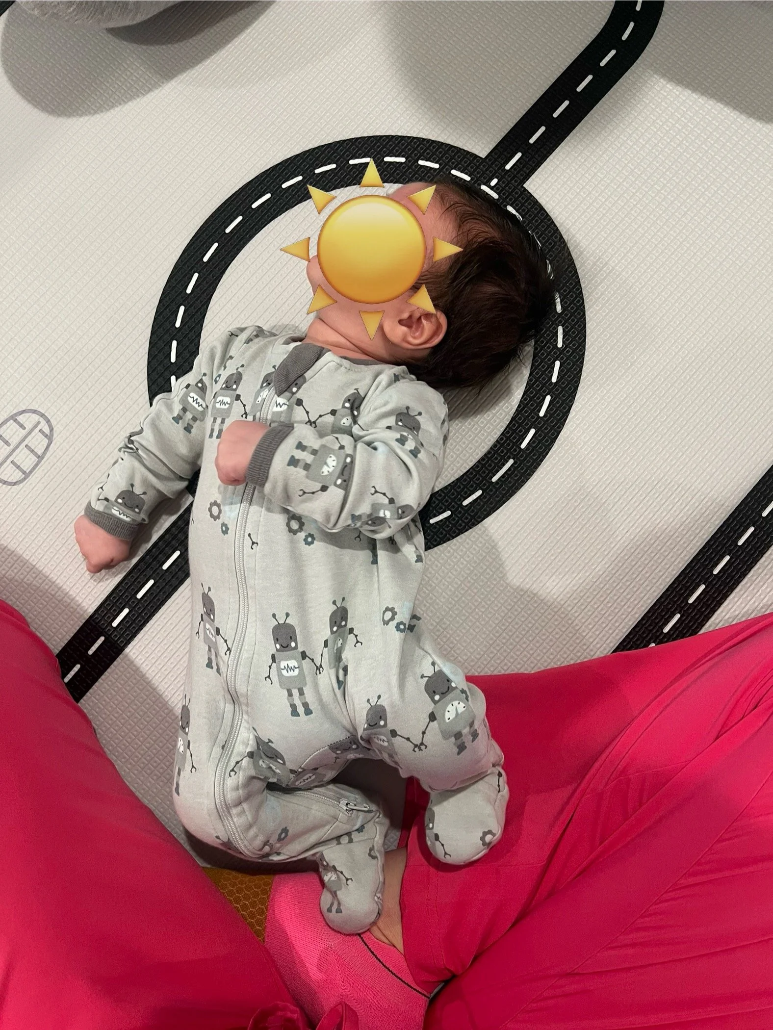 Treatment of Torticollis (whole-body approach) 