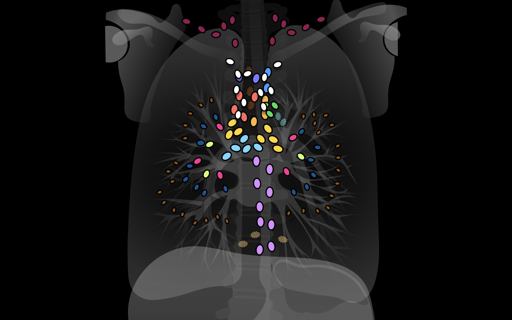 IASLC Lymph Node Map — Radiology Slides