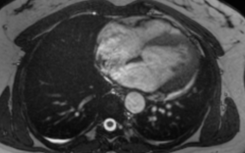 How Chest Radiologists use MRI — Radiology Slides