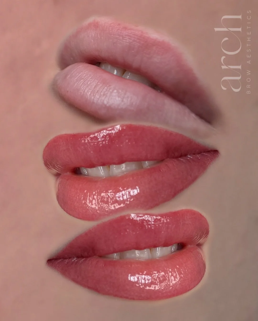 When I tell you I&rsquo;m obsessed with this treatment, believe that I&rsquo;m OBSESSED!!! 😍

Check out the last photo at only 4 weeks healed! They are so pretty, but will get even better over the next 2-4 weeks ❤️&zwj;🔥

#pmu #lipblush #liptattoo 