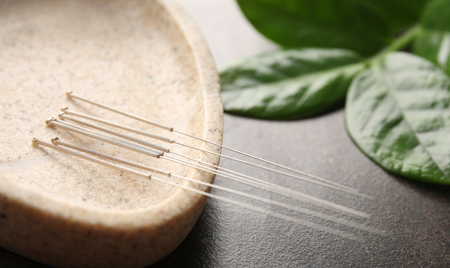 Acupuncture — Dancing Aspen Healing Arts