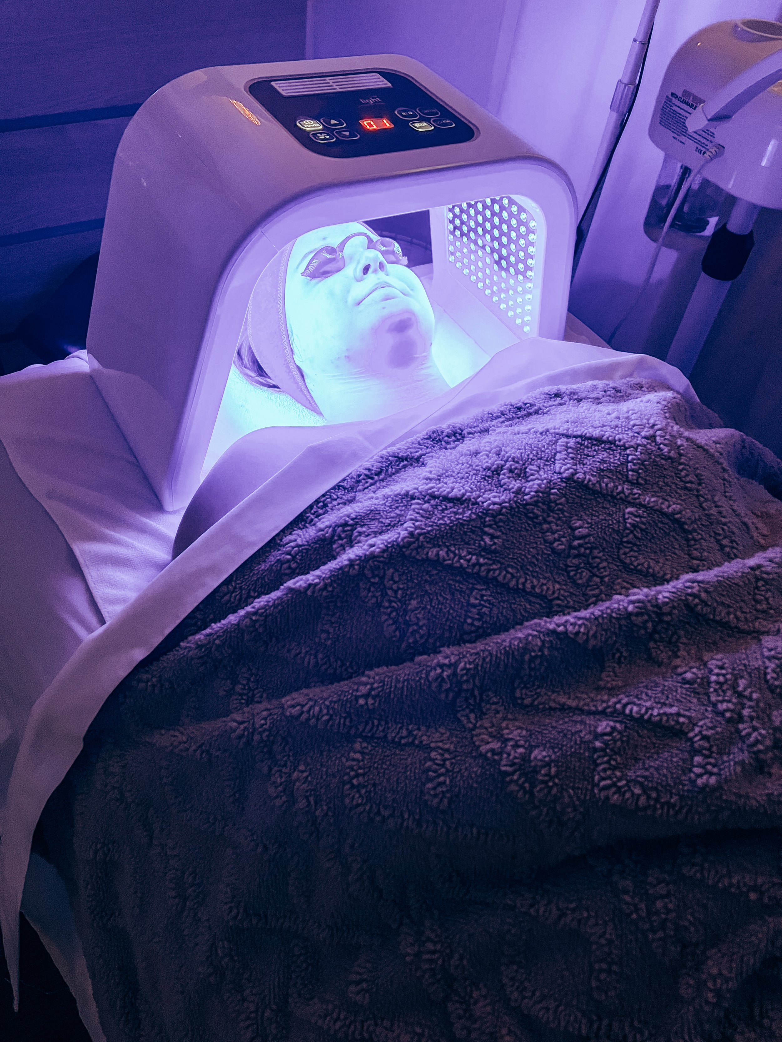 Blue Light Therapy for Acne Prone Skin