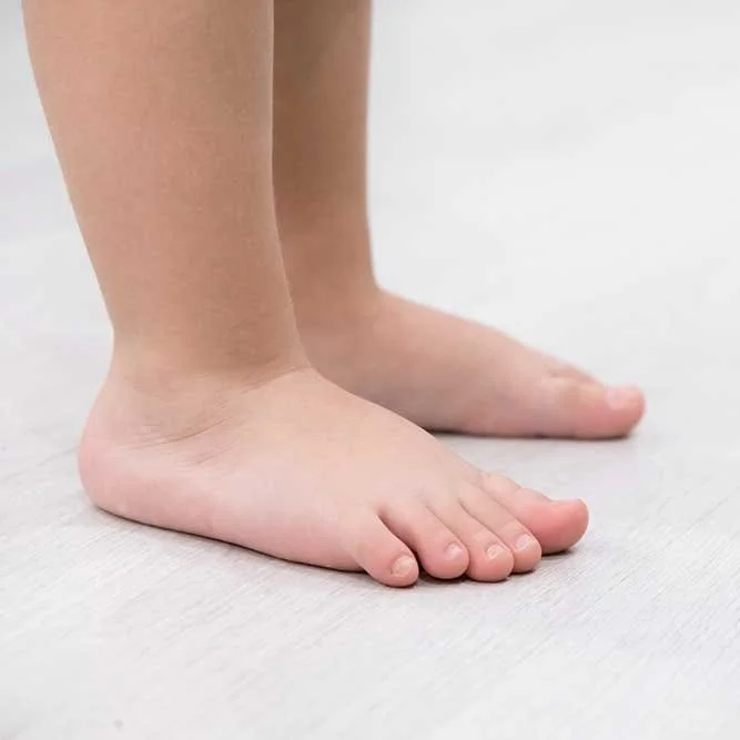 childrens-flat-feet-example.jpg