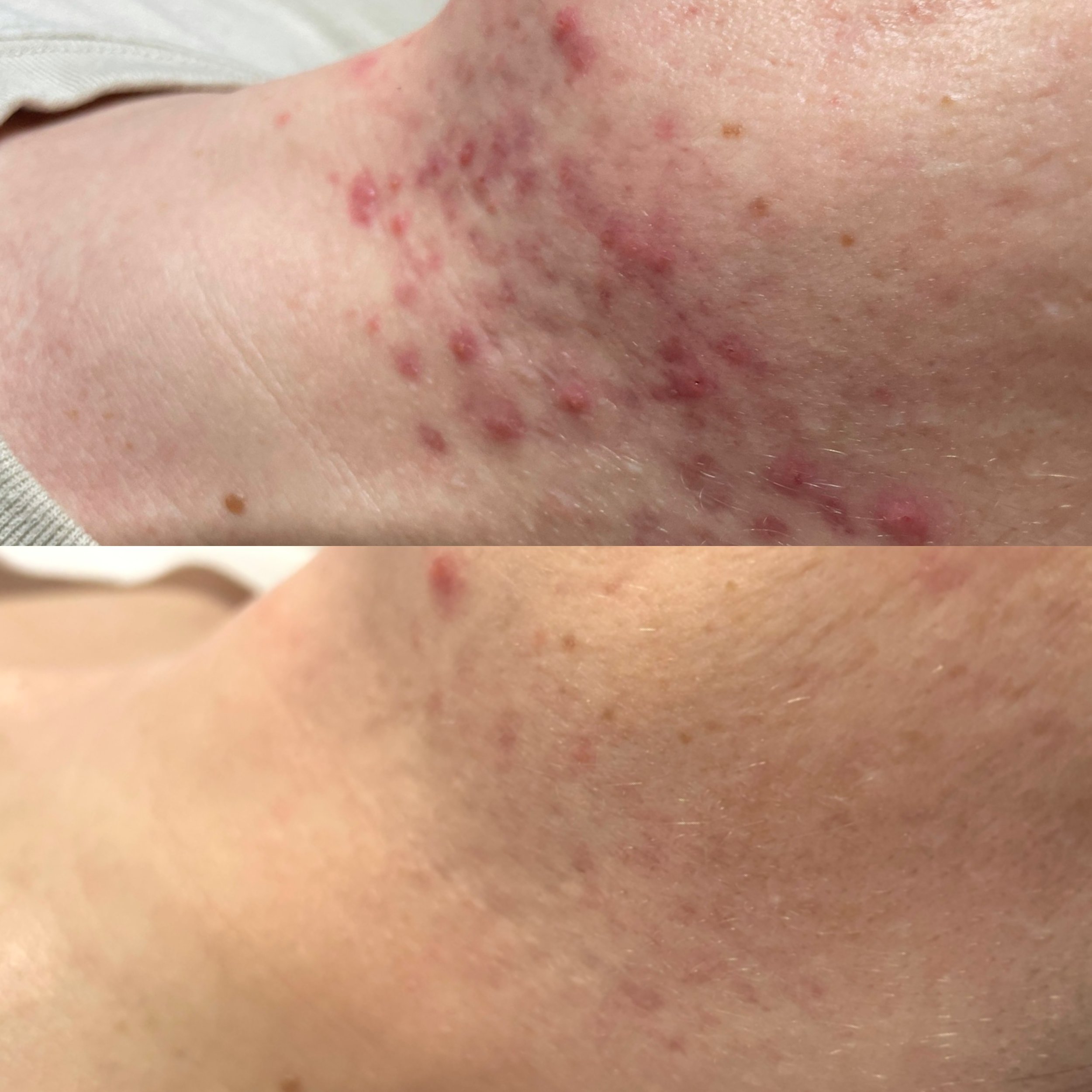“Kenzie is absolutely amazing! I basically had tried everything to clear my acne before coming to her. She has a wealth of knowledge for skincare and truly cares about each of her clients needs. Because of her, my skin is clear and I feel like it’s n