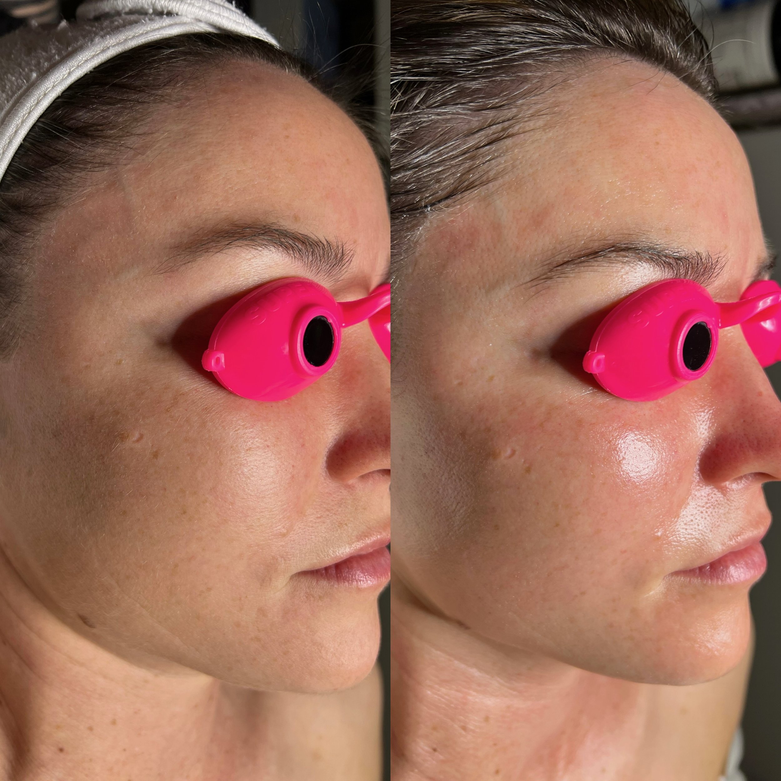 “Received my very first AGE facial and it was wonderful. My skin is glowing, I feel so hydraed and relaxed. I wanted to ask her to shut down and let me nap for the afternoon. Seriously the best way to treat yourself while also doing something amazing