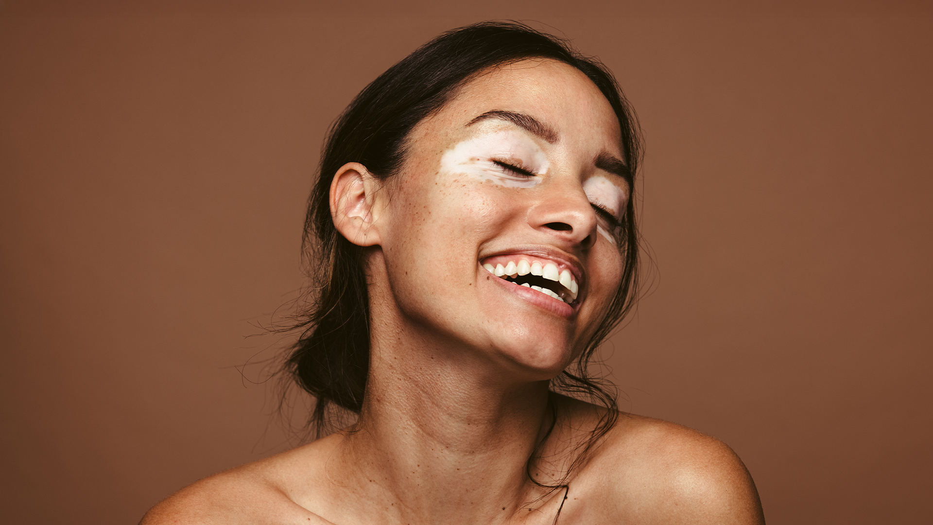 Skinmed setzt auf ZEJA – Strategie, Content &amp; Ad Power im Retainer