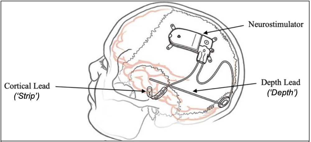 Screen Shot 2023-03-05 at 11.50.15 AM.png
