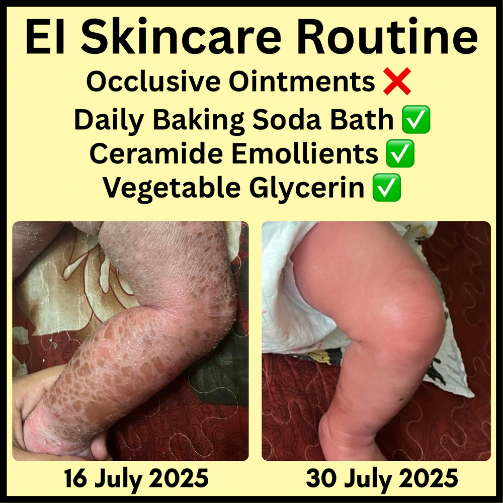 Ointments Vs Emollients Before and After.PNG