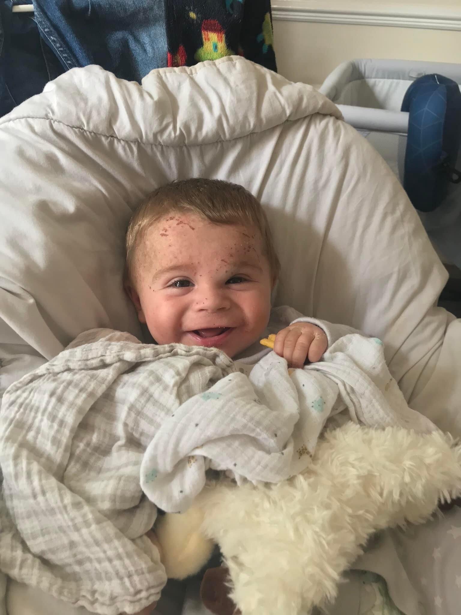A child with Epidermolytic Ichthyosis caused by KRT10 genetic variant