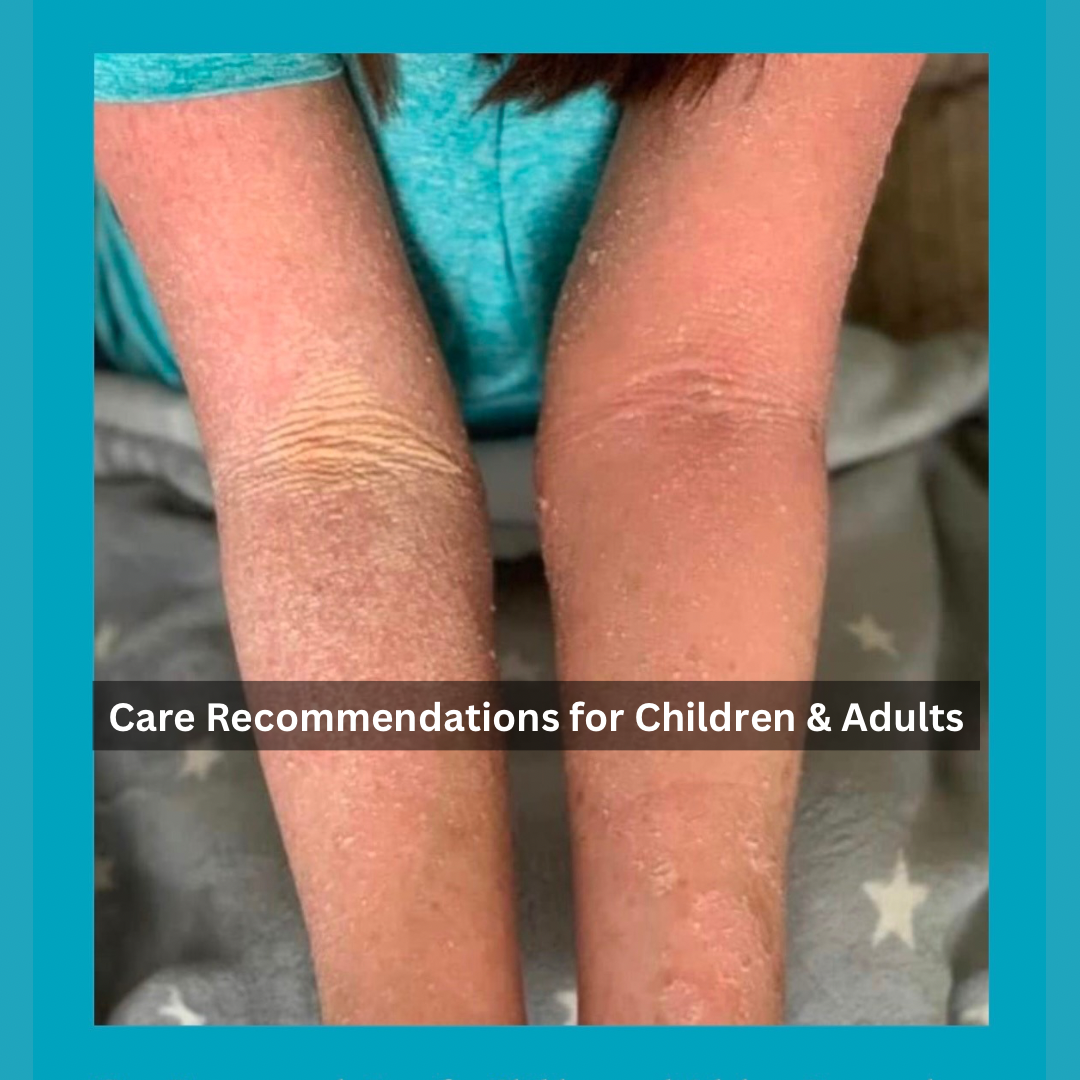 Care Recommendations for Children and Adults - ISG Family Conference 2023