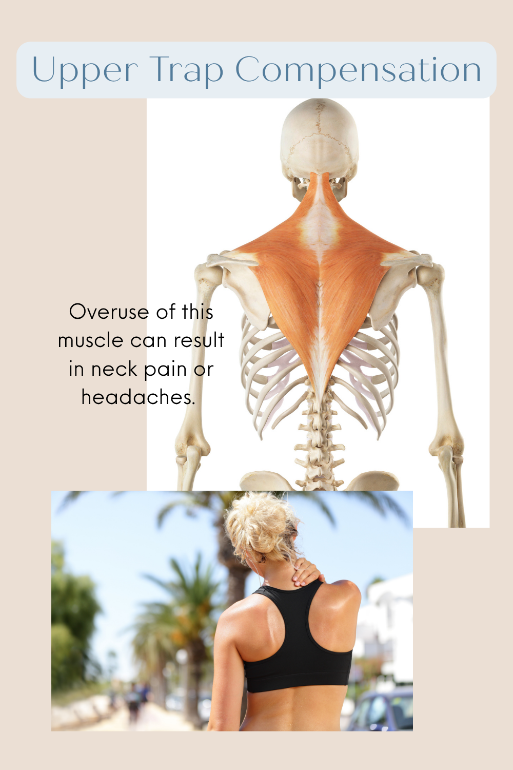 Illustration showing the upper trapezius muscles and their location between the neck and shoulders.