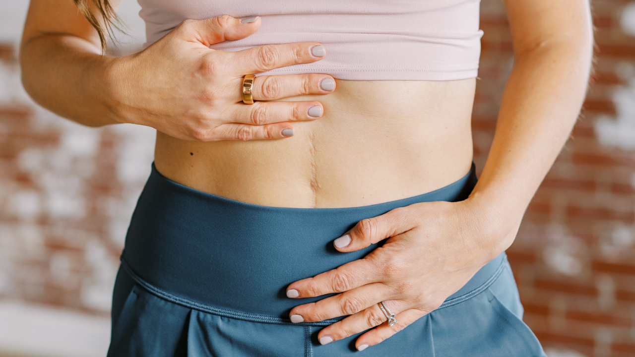 Low Pressure Fitness for Bladder Pain &amp; Interstitial Cystitis