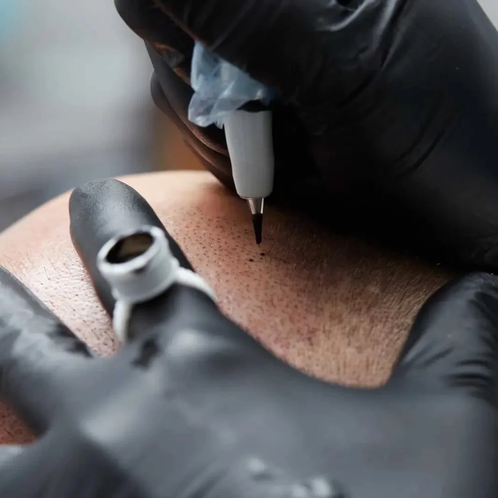 SCALP MICROPIGMENTATION — RIZZIERI ADVANCED ACADEMY