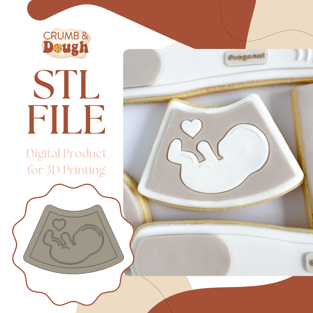 Pregnancy Ultrasound.png