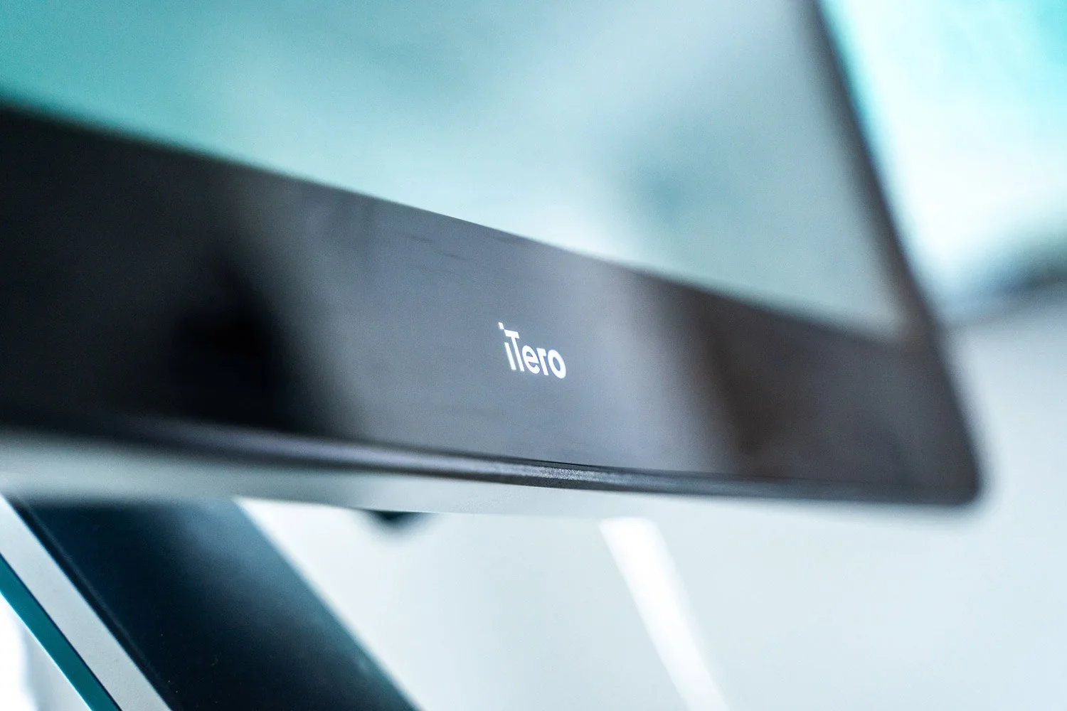 Invisalign® Consultation using itero scanner