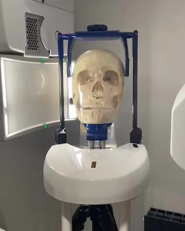 OPG &amp; CBCT scanner 🦷

At Dental Smiles we have a specialist X-ray machine that captures a panoramic view of the entire mouth including the teeth and both upper and lower jaws and the temporomandibular joints (TMJ)

Use of OPG equipment:
Orthodon