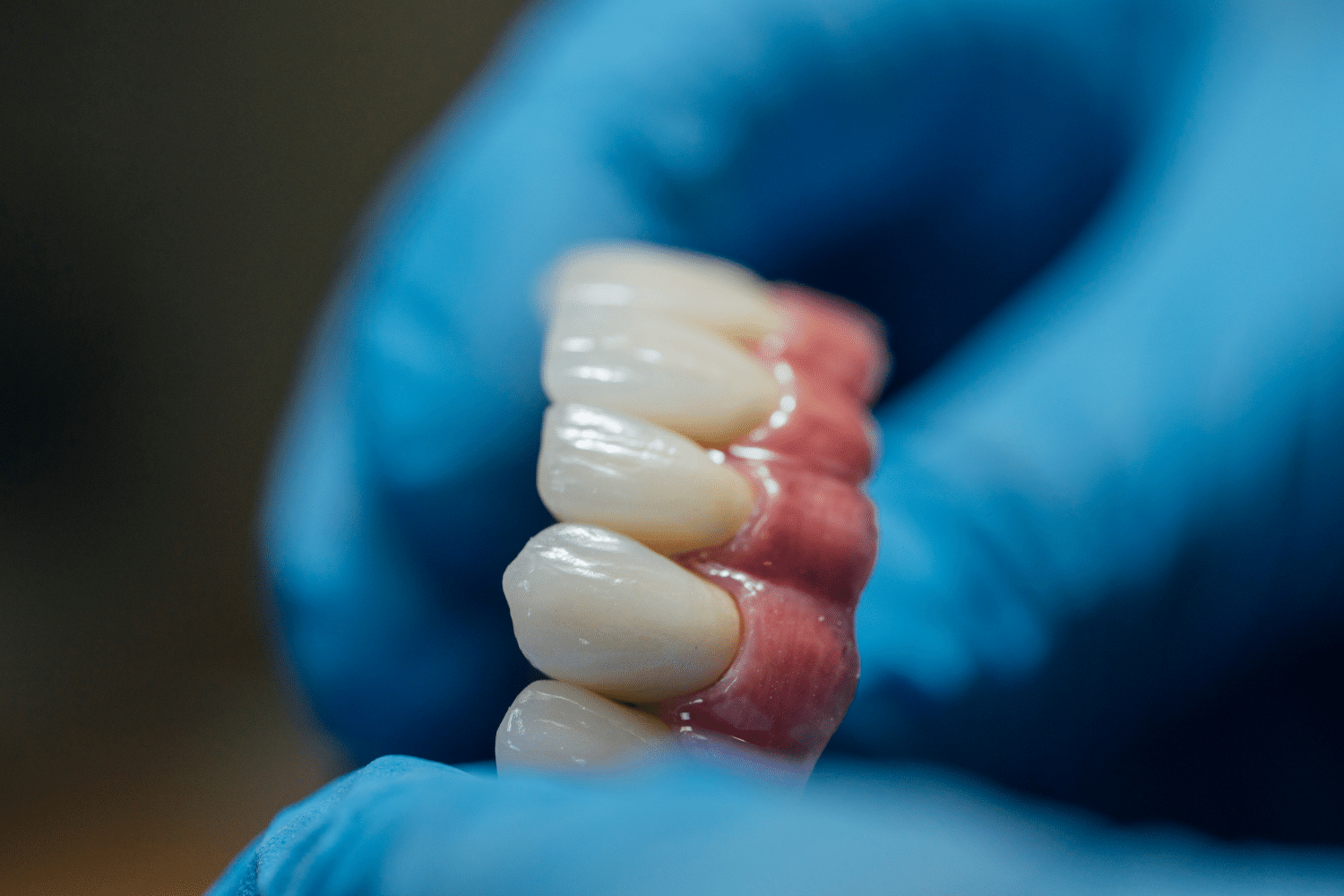 Dentures at Dental Smiles Flagstaff Colchester