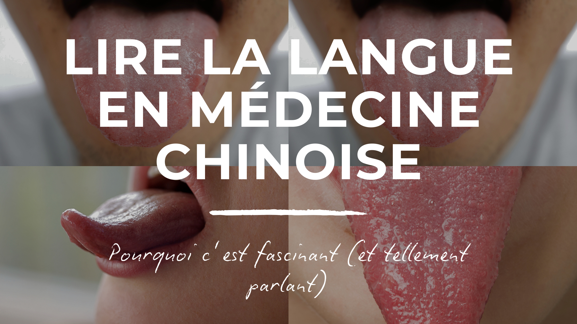 Lire la langue en Médecine ChinoisePourquoi c’est fascinant (et tellement parlant)