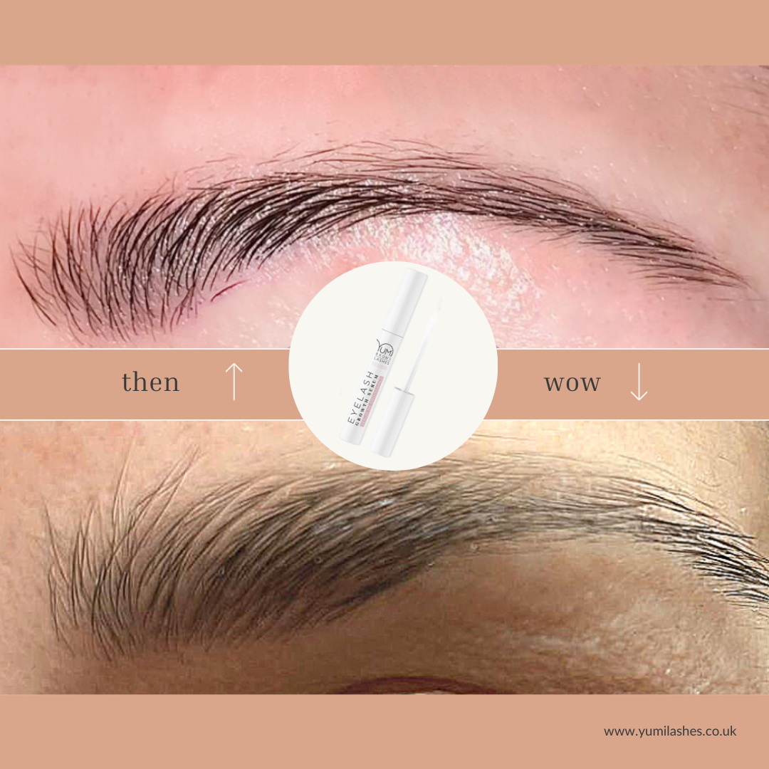 GROWTH SERUM 4.png