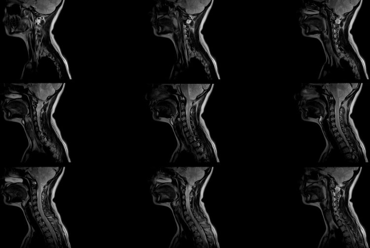 Open MRI Comfortable Diagnostic Imaging Garden Grove Orange