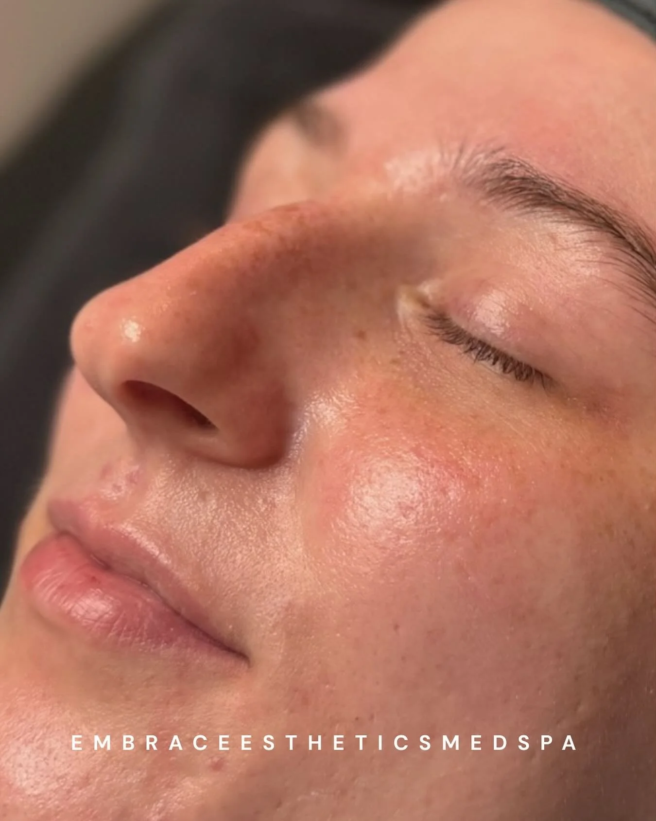 30 minutes to brighter, smoother skin ✨
Our Pro30 facial by @estheticsbydenae is designed to deliver maximum results in minimal time. the perfect pick-me-up for dull, tired skin.
Whether you&rsquo;re on a lunch break or in need of a quick glow boost,
